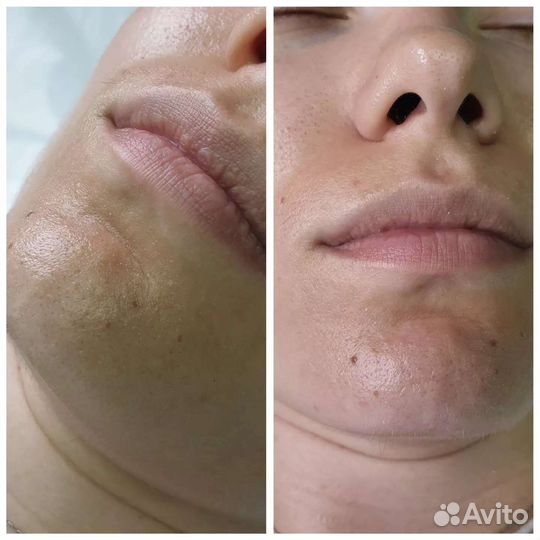 Услуги косметолога нужны модели