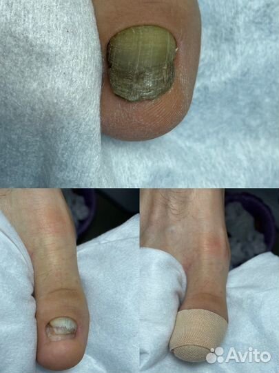 Подологические услуги