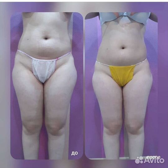 Ручной массаж