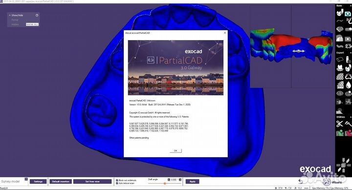 Exocad 3.1 / Exoplan 3.1 Rijeka build 8349 / 8423