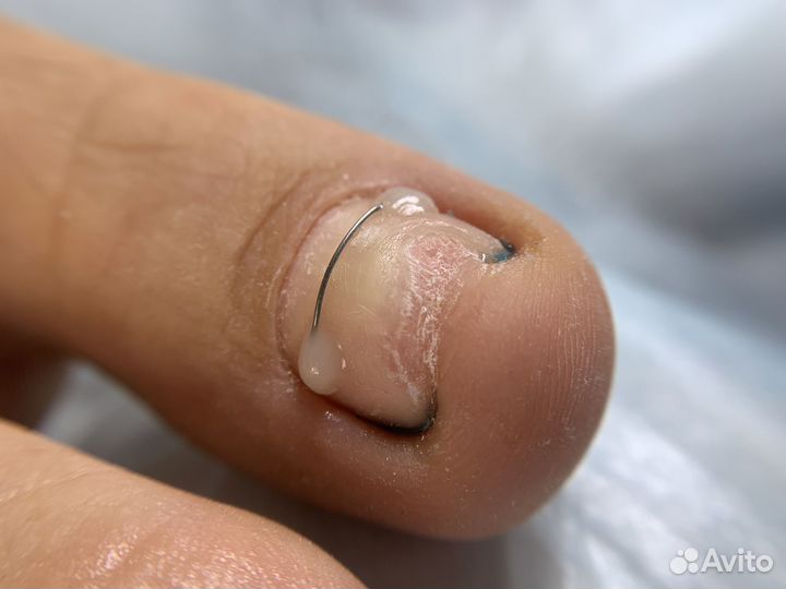 Услуги подолога