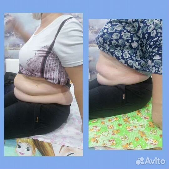 Антицеллюлитный массаж