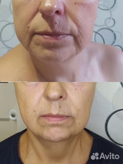 Моделирующий массаж лица и шеи для женщин