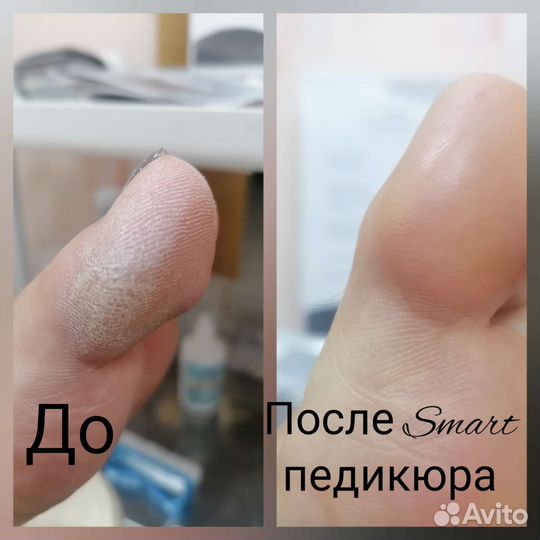 Маникюр и педикюр