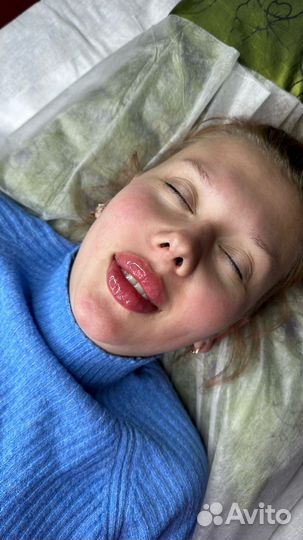 Увеличение губ/кп лица/ботокс обучение