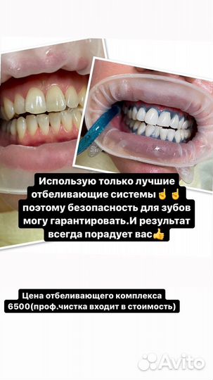 Здоровые,белоснежные зубы