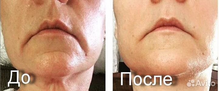 Мануальные техники. Психосоматика. Похудение