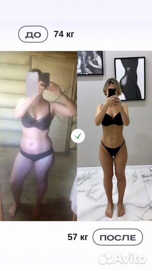 LPG-массаж, похудение