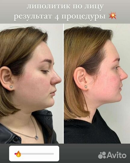 Услуги косметолога