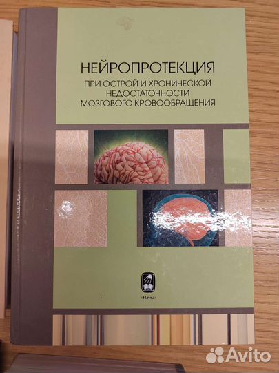 Книги неврология