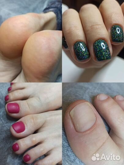 Педикюр/ подолог