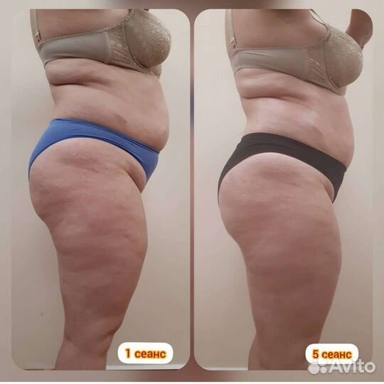 Ручной массаж