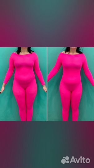 Антицеллюлитный LPG массаж