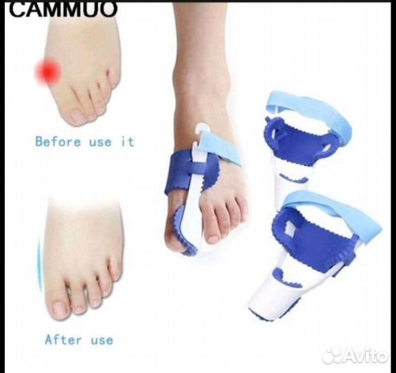 Ортопидический выпрямитель большого пальца на ноге