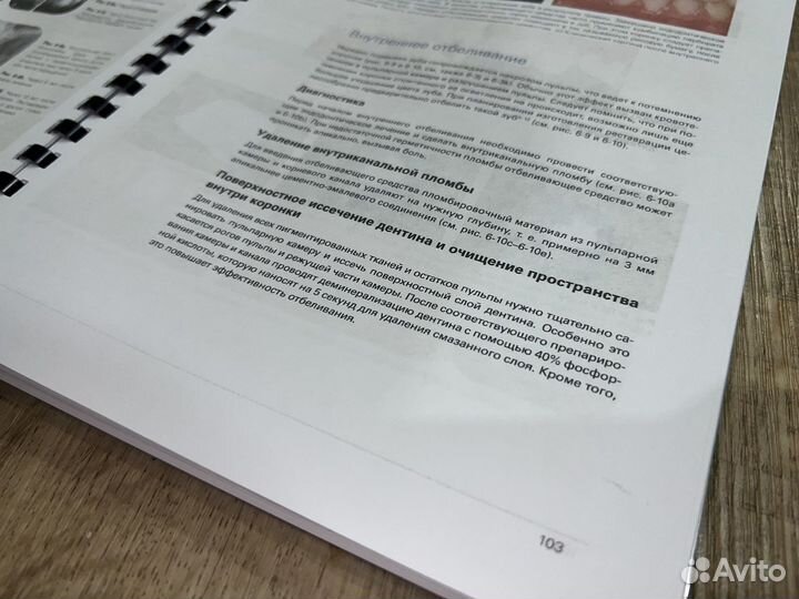 Травма зубов