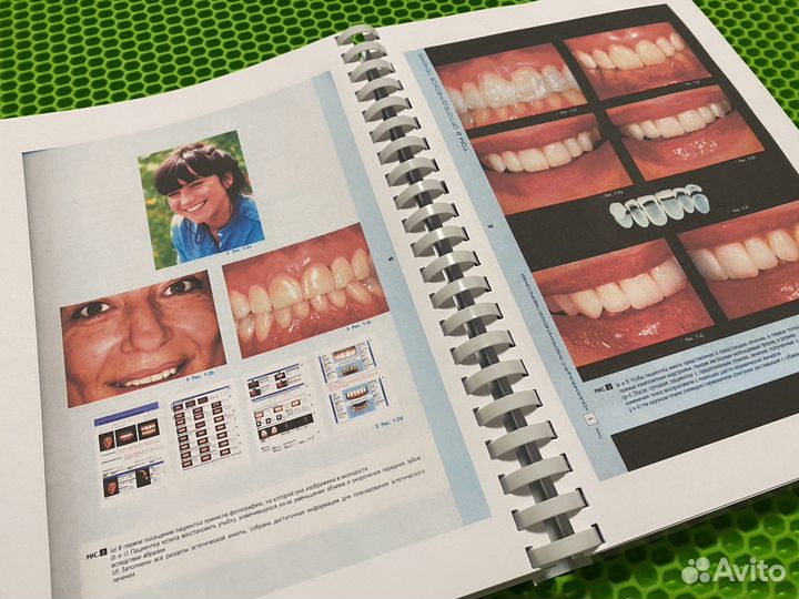 Анализ эстетики Том 2