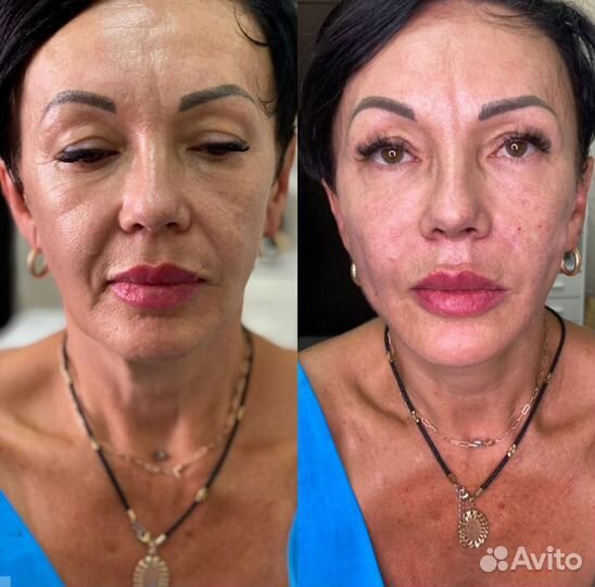 Лицо под ключ (фул фейс). Косметолог