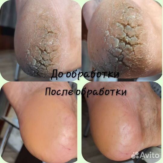 Подология;Педикюр, Маникюр; Наращивание ногтей