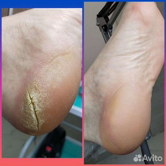 Подолог. Маникюр. Педикюр. Студия Нины Федоровой