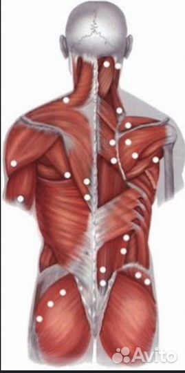 Миопрессура. Акупрессура. Миофасциальная терапия