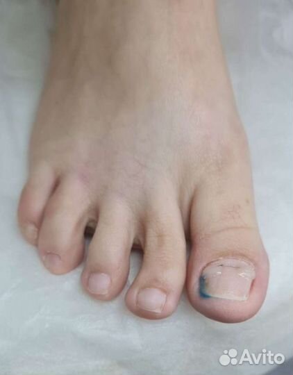 Лечебный педикюр/ подолог с мед.образованием