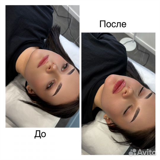 Модель на контурную пластику губ