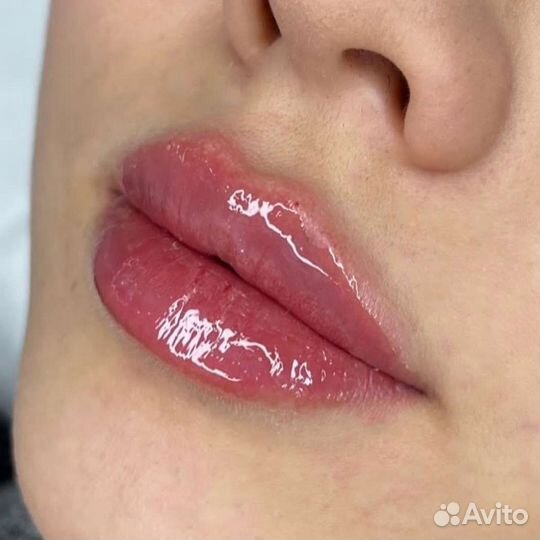 Увеличение губ
