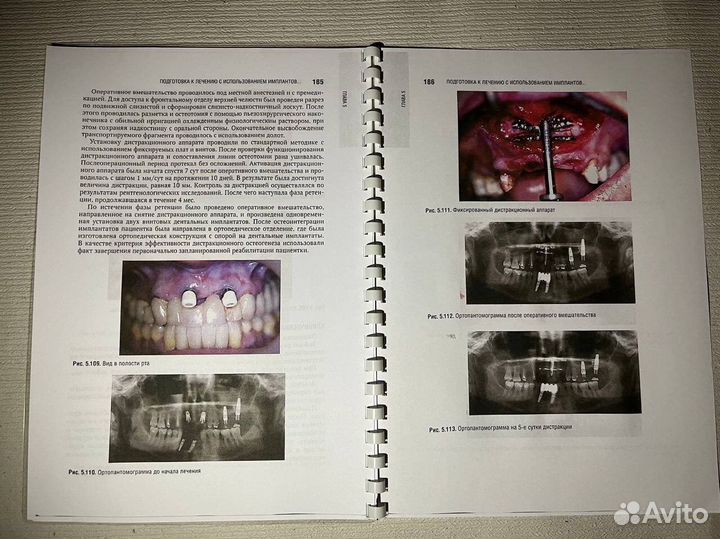 Дентальная имплантация учебная литература
