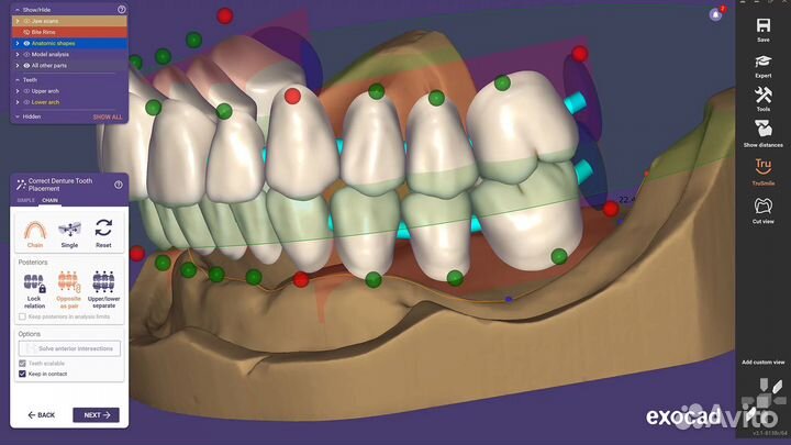 ExoCad 3.1 Rijeka ExoCad 3.0 Galway