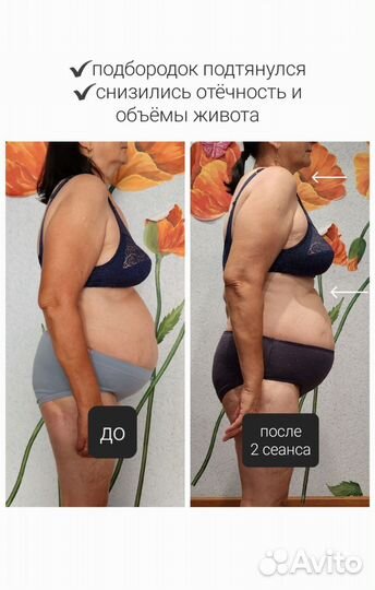 Остеопластический массаж спины и живота