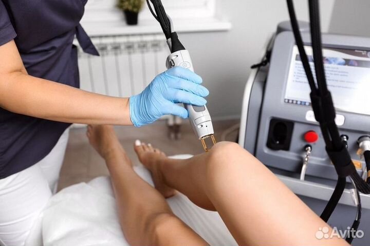 Бизнес лазерной эпиляции с клиентской базой