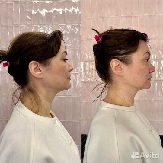 Массаж лица