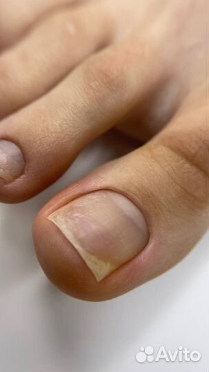 Базовый курс педикюра