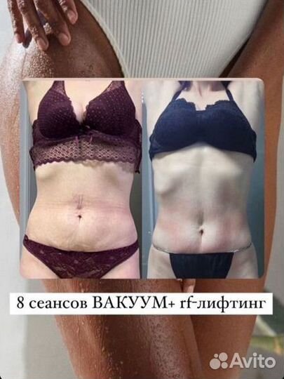 Аппаратный массаж