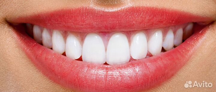 Зуботехническая Лаборатория на Сизова