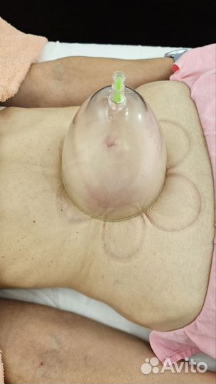 Висцеральный массаж по Огулову