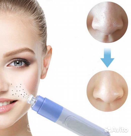 Очиститель угрей и пор вакуумный