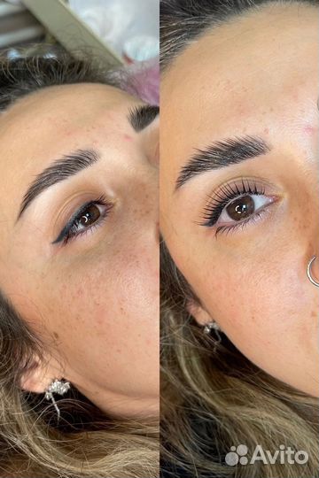 Стрейчинг ресниц