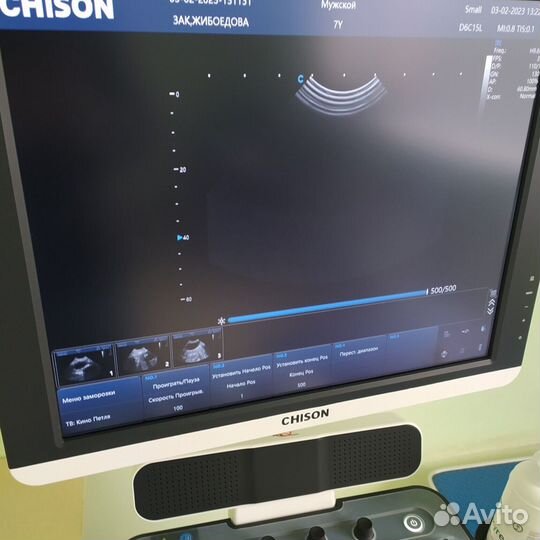 Узи аппарат Chison