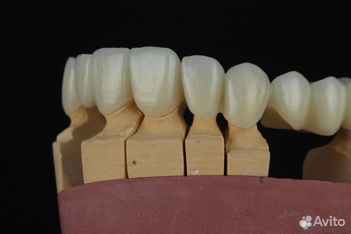 3d фрезеровка зубов из циркония cad cam