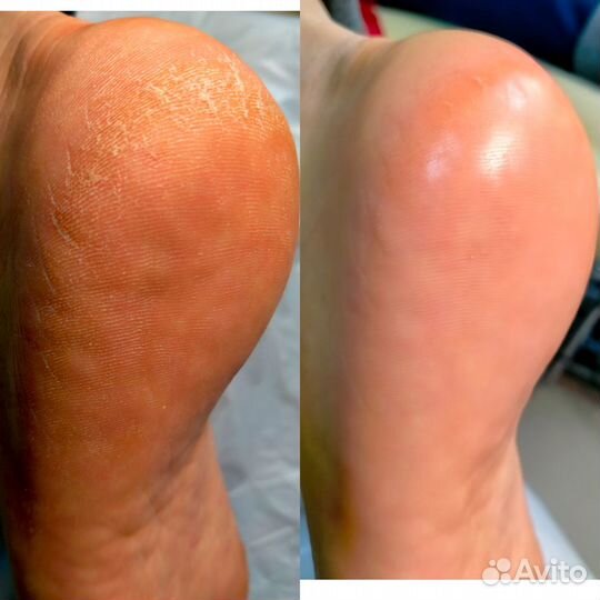 Комбинированный маникюр +гель лак