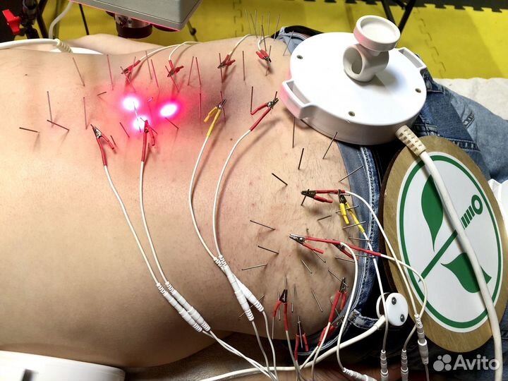 Лечение грыжи позвоночника