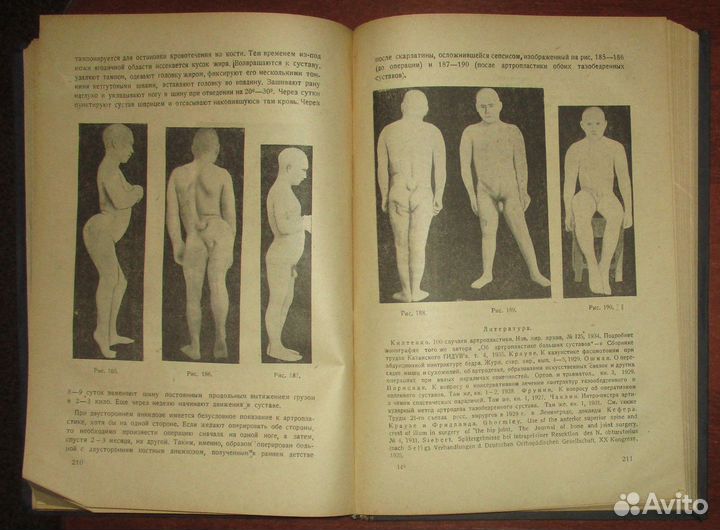 Фридланд М. О. Курс ортопедии. Часть II. Частная о