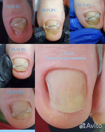 Маникюр, педикюр