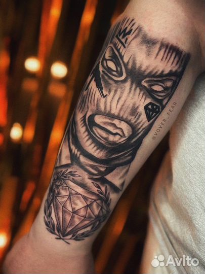 Удаление татуировок