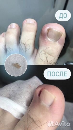 Мастер педикюра/сложные стопы/трещины/мозоли