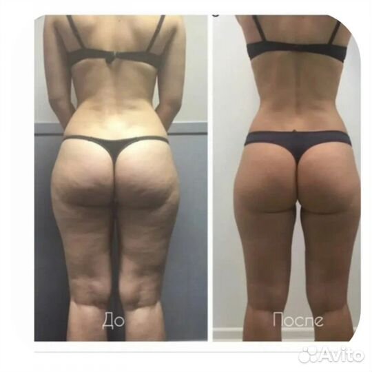 Студия массажа bodylinespb