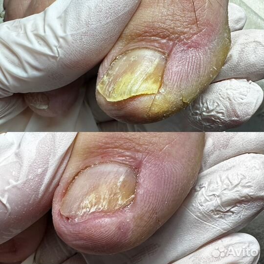Подолог мастер педикюра