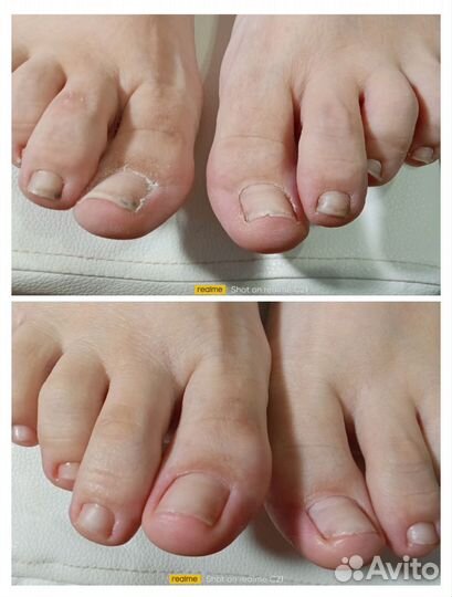 Педикюр (женский, мужской),smart-педикюр