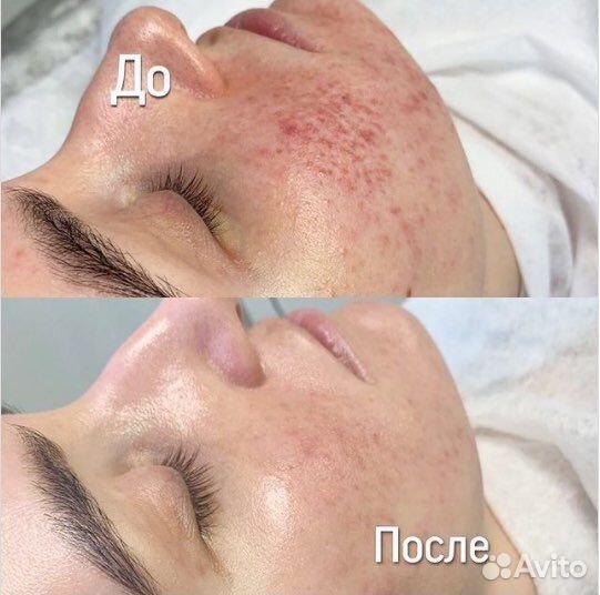 Услуги косметолога